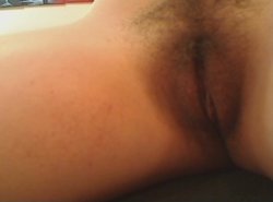 Bruise 1.jpg