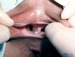 2Vaginas.jpg