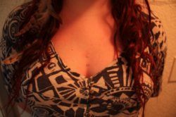 dermals.jpg