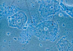 Vaginose-G15.jpg