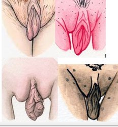 vulva.JPG