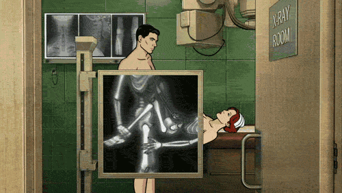archer-xray.gif
